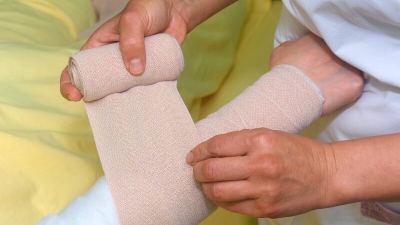 Lymphedema Treatment Typically Begins With Bandages and Compression