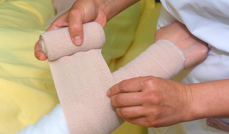 Lymphedema Treatment Typically Begins With Bandages and Compression