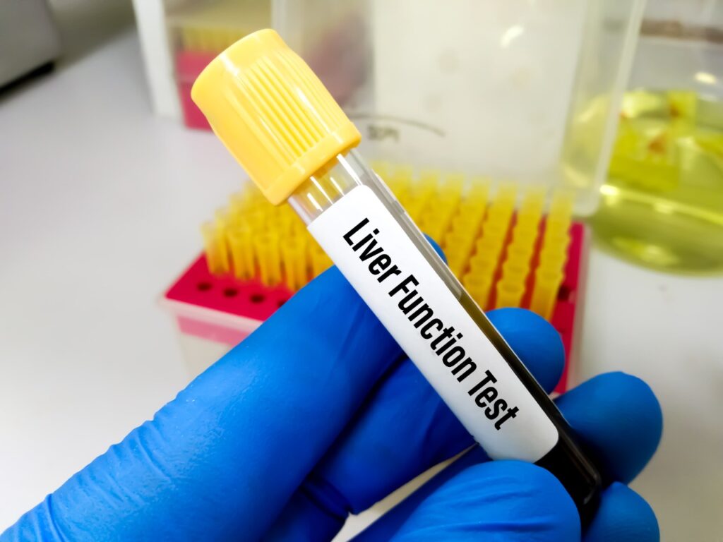 Liver Function Testing