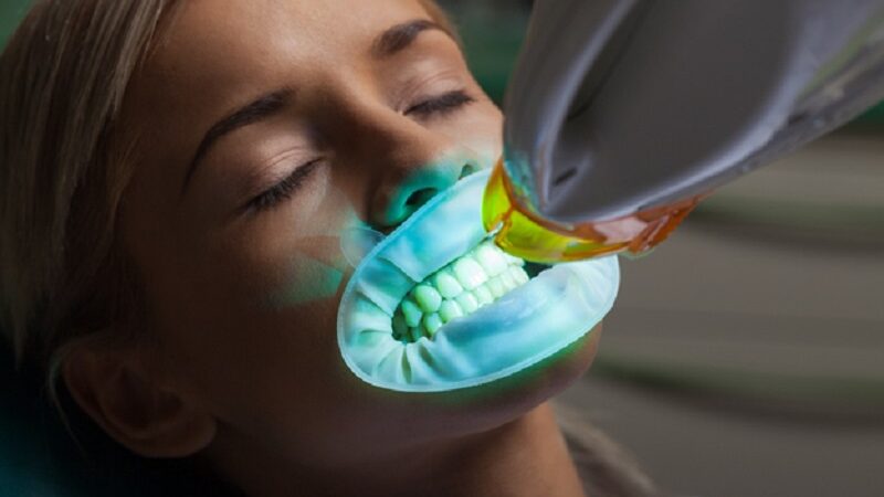 Teeth whitening with your dentist for a gleaming smile