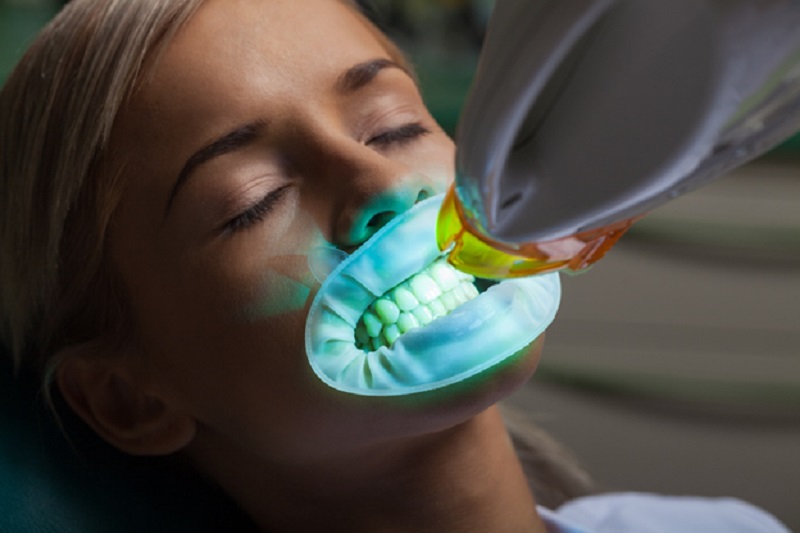 Teeth whitening with your dentist for a gleaming smile