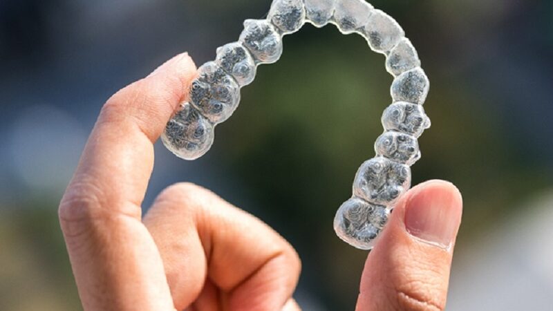 Embracing orthodontic marvels: a journey towards a confident smile with braces
