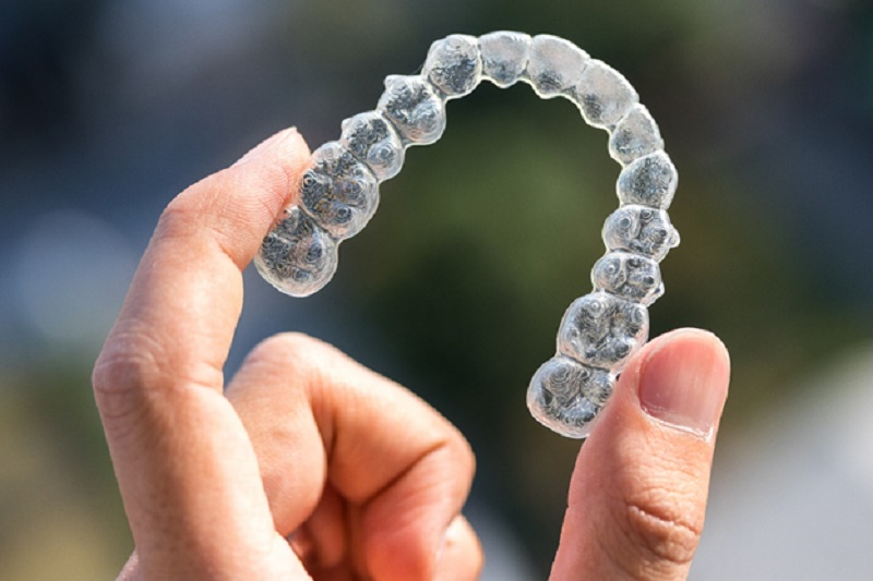Embracing orthodontic marvels: a journey towards a confident smile with braces