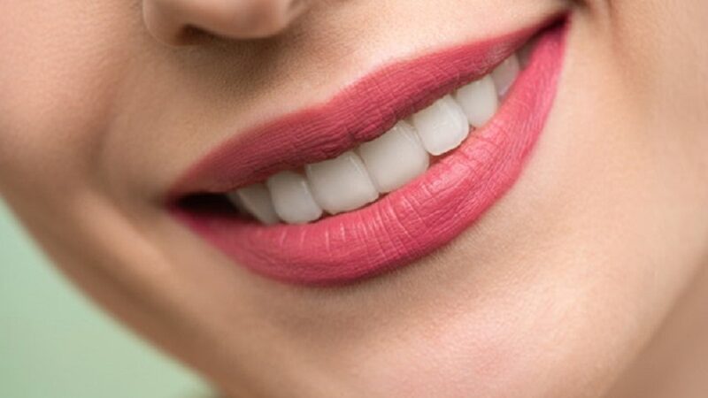 Advantages of teeth straightening with braces in Stoke-on-Trent