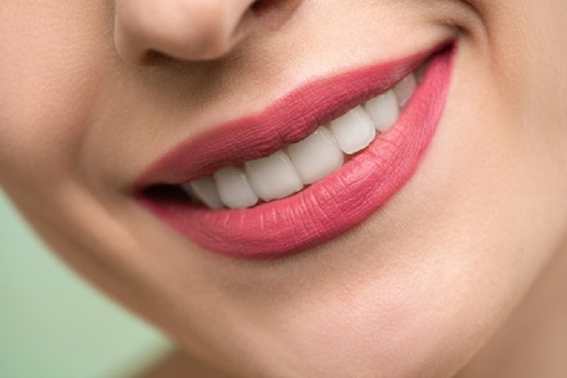 Advantages of teeth straightening with braces in Stoke-on-Trent