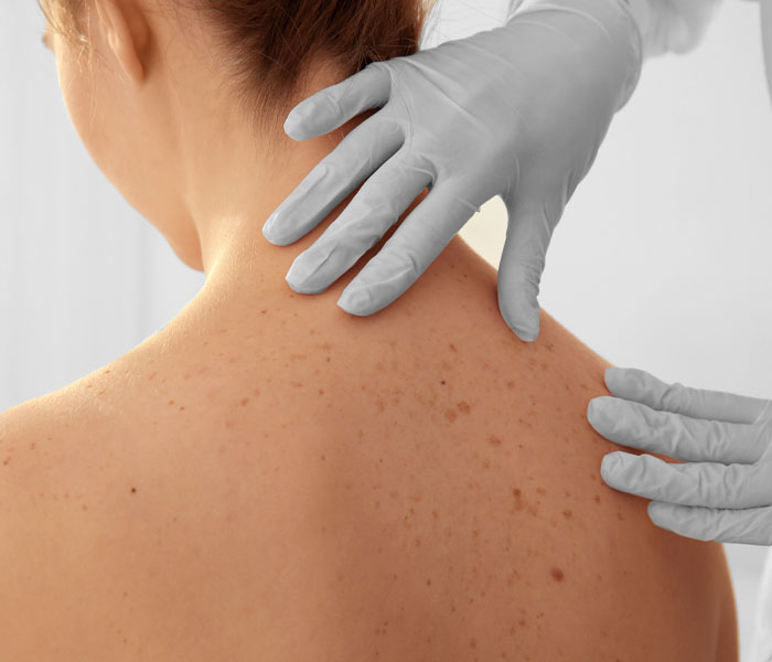 Common Skin Conditions and How Dermatologists Treat Them