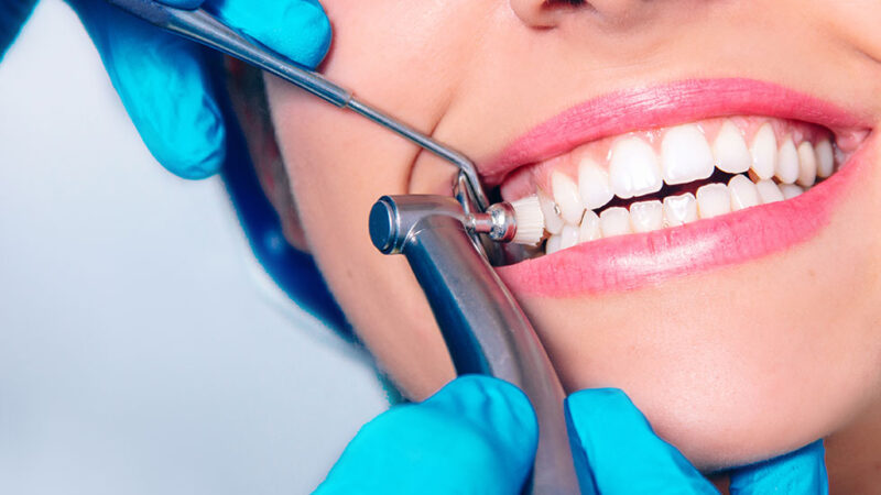 Is Dental Cleaning A Painful Process?