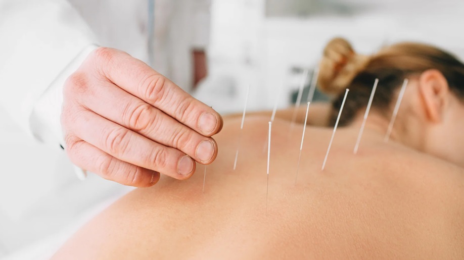The Role of Facial Acupuncture in Boosting Collagen Production