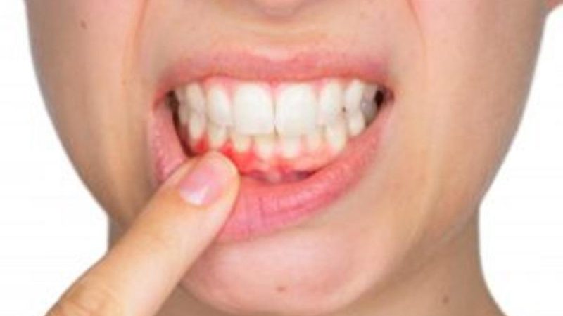 When to See a Periodontist and Why Gum Health Matters