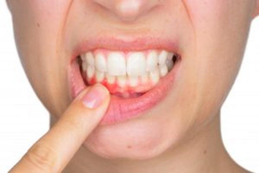 When to See a Periodontist and Why Gum Health Matters