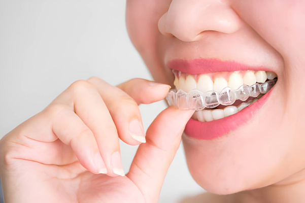 Invisalign for Adults is Never Too Late for a Perfect Smile