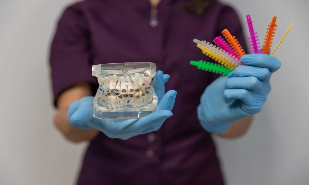 Braces Explained: What Happens During Orthodontic Treatment?