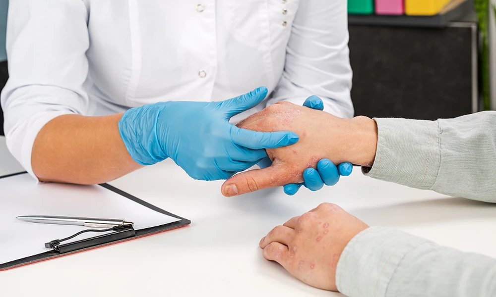 Managing Itchy Skin with Traditional Chinese Medicine